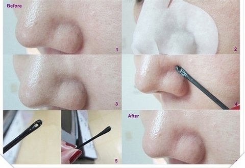 Ciracle Blackhead Off Sheet Салфетки для удаления черных точек