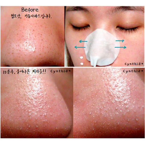 Ciracle Blackhead Off Sheet Салфетки для удаления черных точек