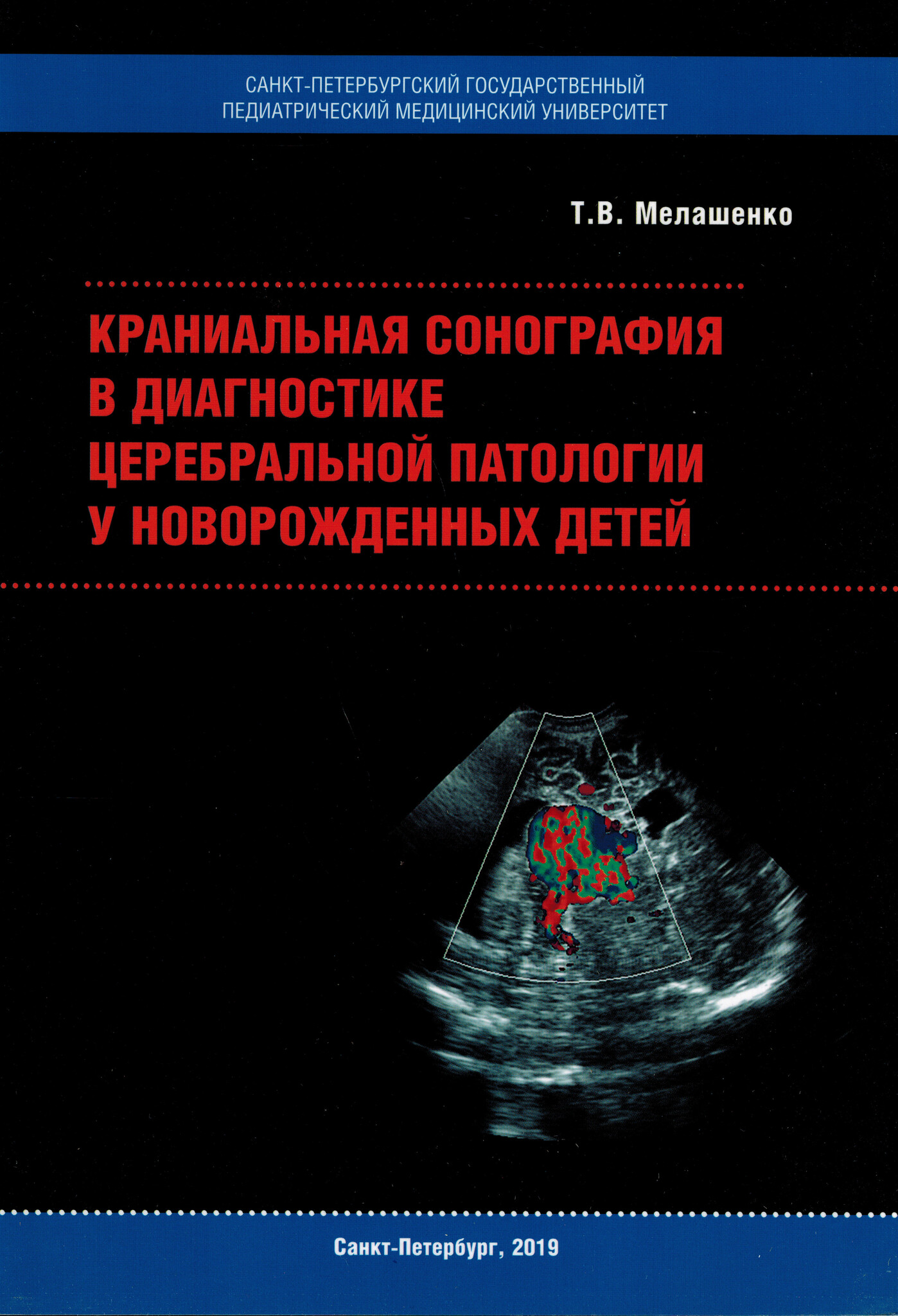 Книги студентам медикам Краниальная сонография в диагностике церебральной патологии у новорожденных детей 212042022.jpg