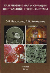 Кавернозные мальформации центральной нервной системы