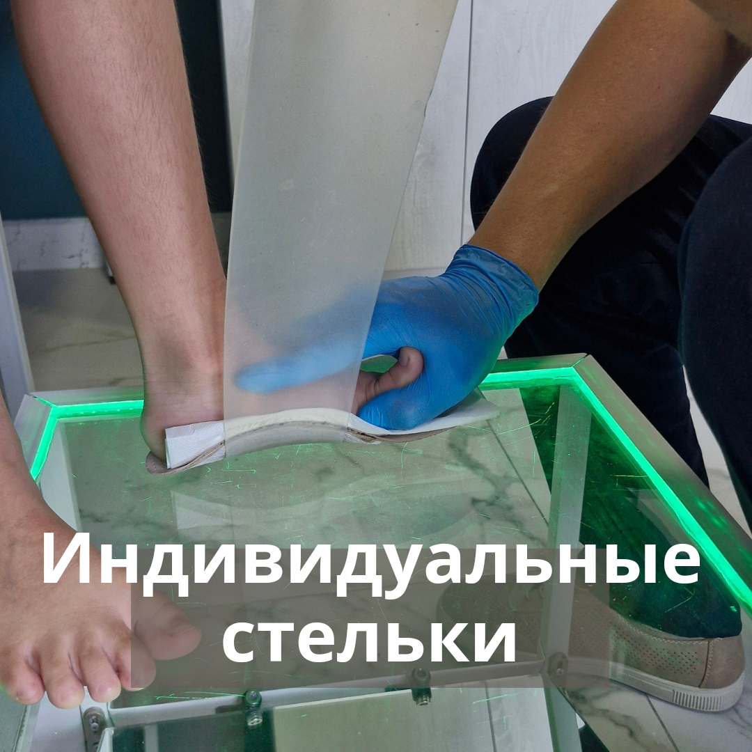 Изготовление индивидуальных стелек
