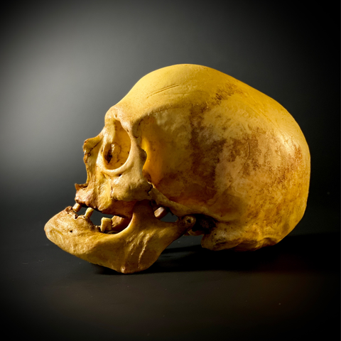 Женский череп человека «Старуха» (анатомическая модель)