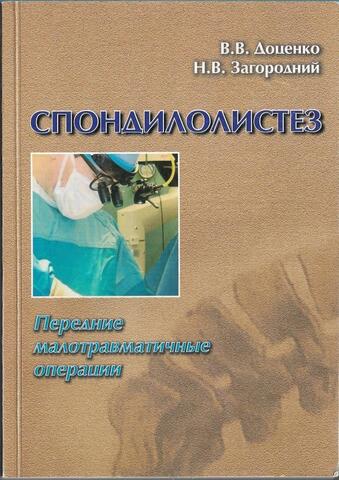 Спондилолистез. Передние малотравматичные операции