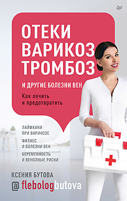 Отеки, варикоз, тромбоз и другие болезни вен. Как лечить и предотвратить отеки варикоз тромбоз и другие болезни вен как лечить и предотвратить