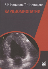 Кардиомиопатии