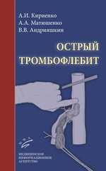 Острый тромбофлебит
