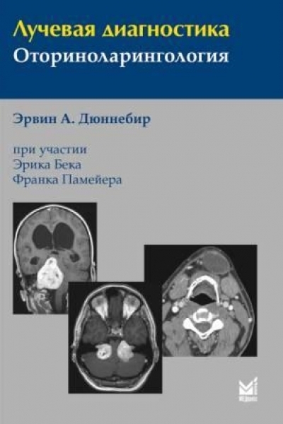 Лучевая Диагностика. Оториноларингология