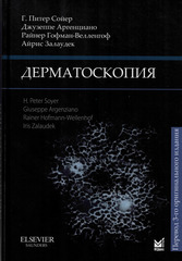 Дерматоскопия