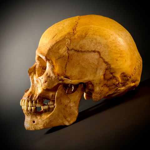 Череп человека женский с метопизмом (анатомическая модель)