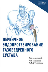 Первичное эндопротезирование тазобедренного сустава