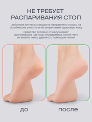 Кератолитик для пяток (KERATOLYTIC), 400мл