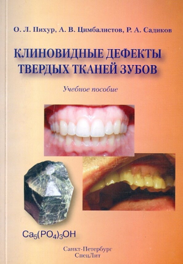 Патология твердых тканей. Клиновидный дефект твердых тканей зуба. Дефект ытвердых туаней зубов. Дефекты твердых тканей зубов.
