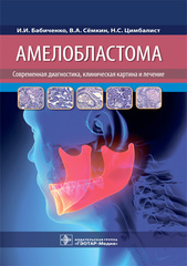 Амелобластома: современная диагностика, клиническая картина и лечение