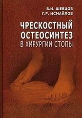 Чрескостный остеосинтез в хирургии стопы