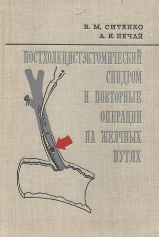 Постхолецистэктомический синдром и повторные операции на желчных путях