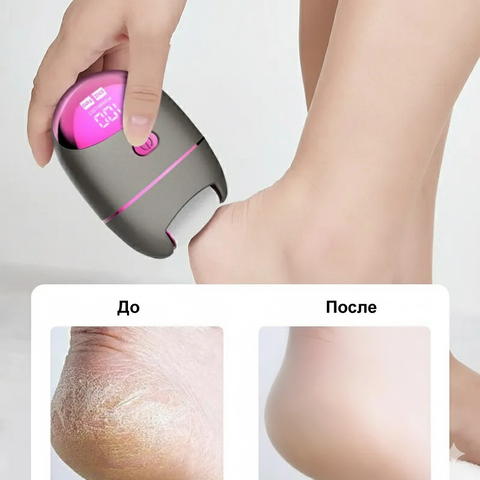 Электрическая пемза New Mini