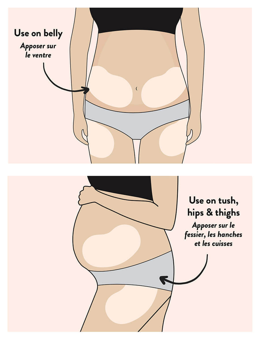 Патчи силиконовые против расстяжек при беременности Silicone Skin Defense Belly Bandit
