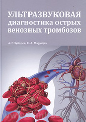 Ультразвуковая диагностика острых венозных тромбозов. Руководство для врачей + CD