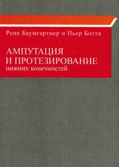 Ампутация и протезирование нижних конечностей