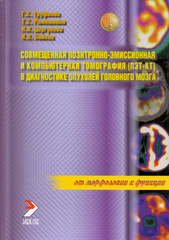 Совмещенная позитронно-эмиссионная компьютерная томография (ПЭТ-КТ) в диагностике опухолей головного мозга