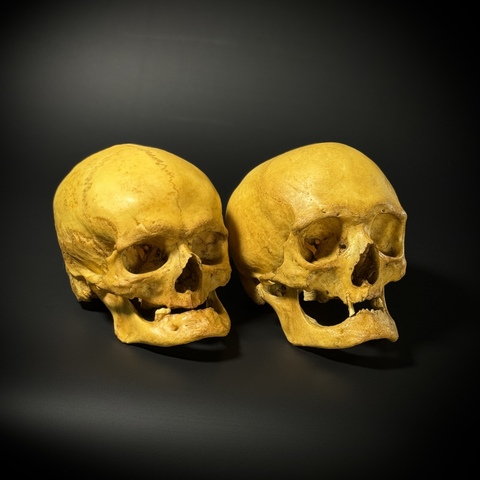 Набор черепов (анатомические модели)