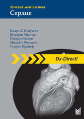 Лучевая диагностика. Сердце
