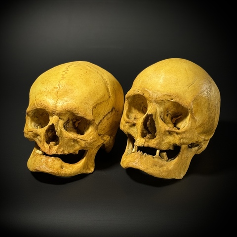 Набор черепов (анатомические модели)