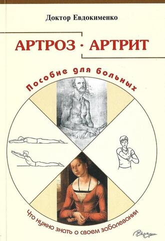 Артроз. Артрит. Пособие для больных