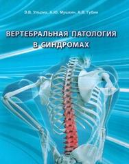 Вертебральная патология в синдромах