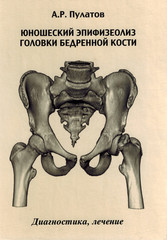 Юношеский эпифизеолиз головки бедренной кости