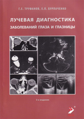 Лучевая диагностика заболеваний глаза и глазницы