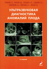 Ультразвуковая диагностика аномалий плода. Руководство для врачей