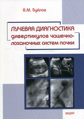 Лучевая диагностика дивертикулов чашечно-лоханочных систем почки
