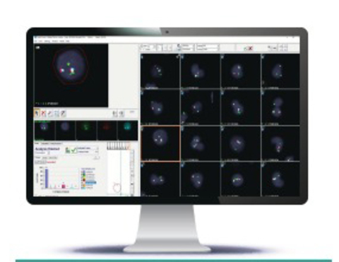 HiFISH — передовое решение для цифрового сканирования и анализа FISH с поддержкой ИИ.