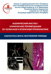 Ишемический инсульт: клинические рекомендации по первичной и вторичной профилактике