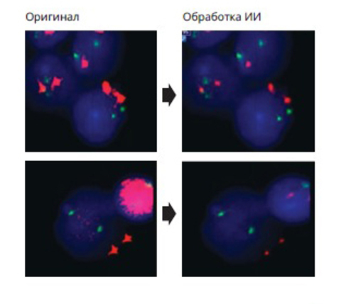 HiFISH — передовое решение для цифрового сканирования и анализа FISH с поддержкой ИИ.
