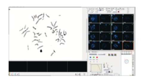 HiFISH — передовое решение для цифрового сканирования и анализа FISH с поддержкой ИИ.
