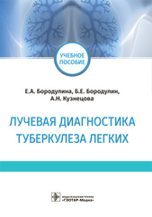 Лучевая диагностика туберкулеза легких : учебное пособие