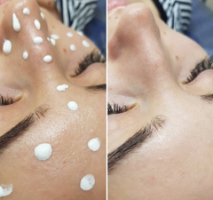 Капсулы для фонофореза 