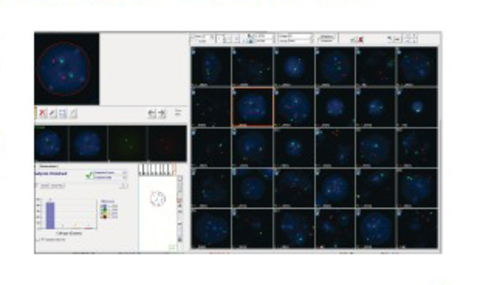 HiFISH — передовое решение для цифрового сканирования и анализа FISH с поддержкой ИИ.