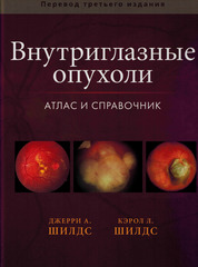 Внутриглазные опухоли. Атлас и справочник