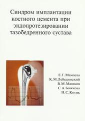 Синдром имплантации костного цемента при эндопротезировании тазобедренного сустава