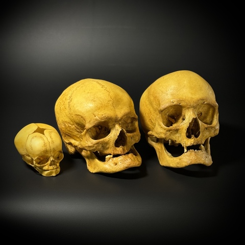 Набор черепов (анатомические модели)