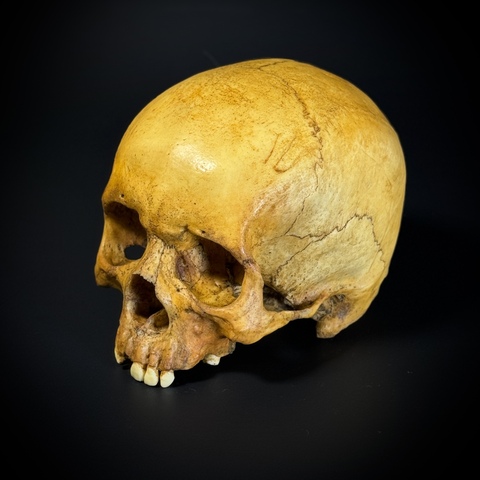 Мужской череп человека без нижней челюсти (анатомическая модель)