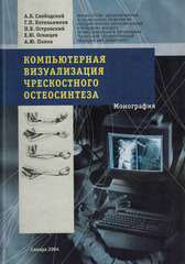 Компьютерная визуализация чрескостного остеосинтеза