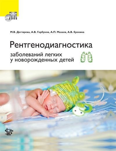 Книги по неонатологии Рентгенодиагностика заболеваний легких у новорожденных детей+ CD rentgenodia_zab_legk.jpg