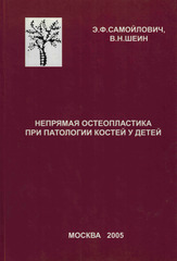 Непрямая остеопластика при патологии костей у детей