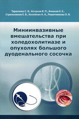 Миниинвазивные вмешательства при холедохолитиазе и опухолях большого дуоденального сосочка