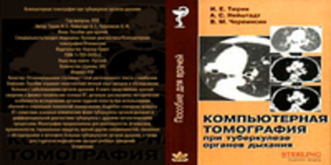 Тюрин И. Е., Нейштадт А. С., Черемисин В. М. - Компьютерная томография при туберкулезе органов дыхания