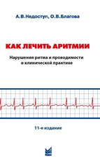 Как лечить аритмии. Нарушения ритма и проводимости в клинической практике